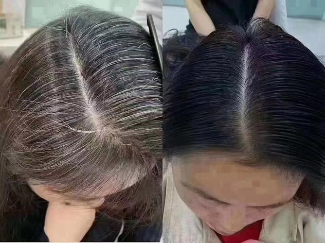 女人梦见长好多白头发啥意思啊