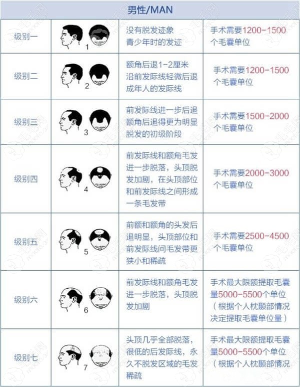 植发的最佳年龄