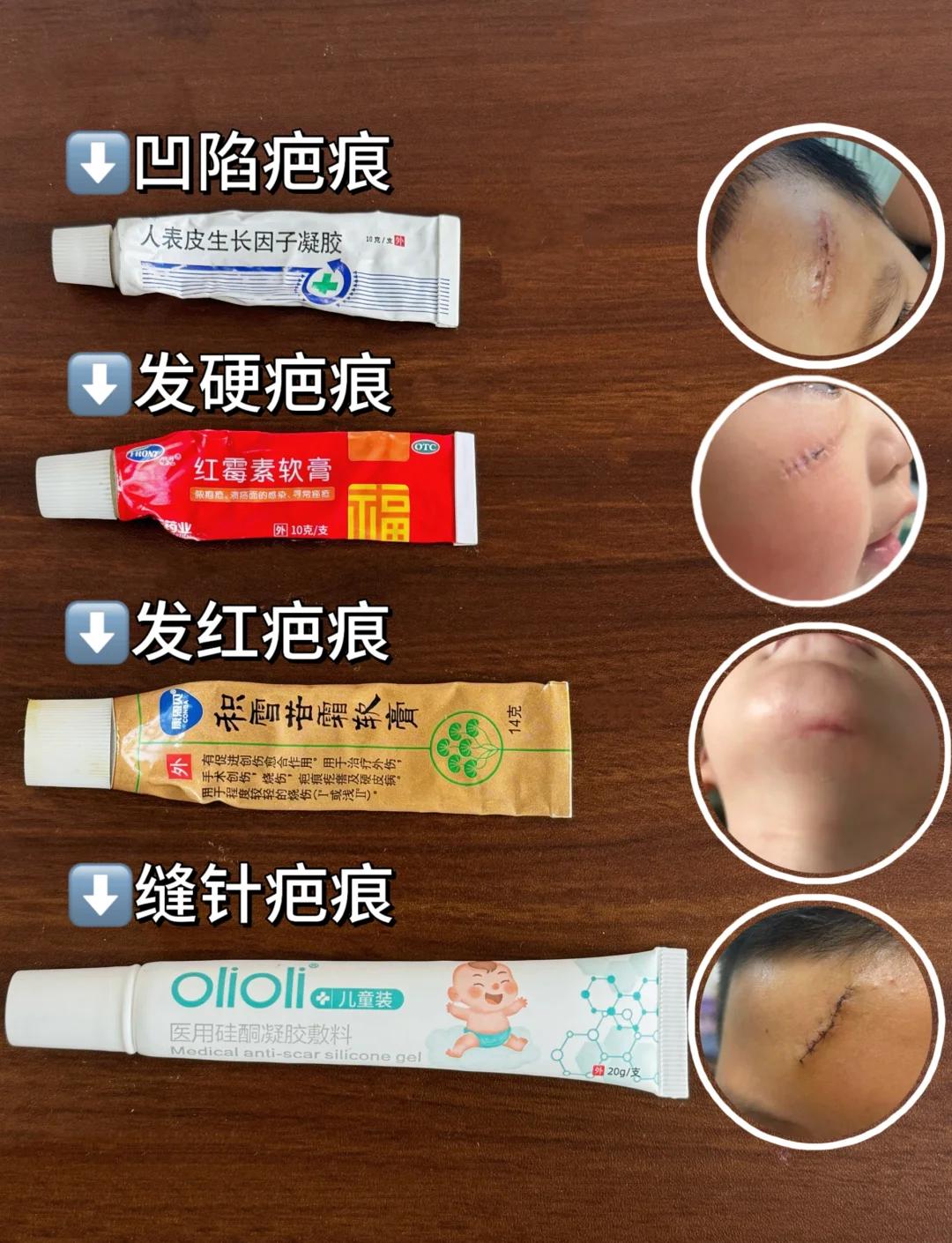 泰冰菱