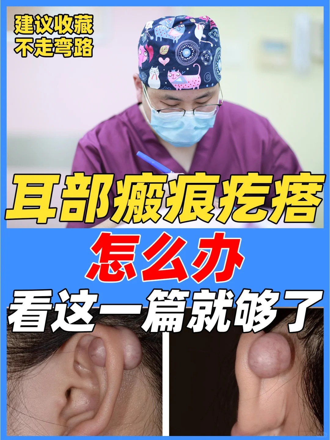 新扎耳洞发炎怎么办