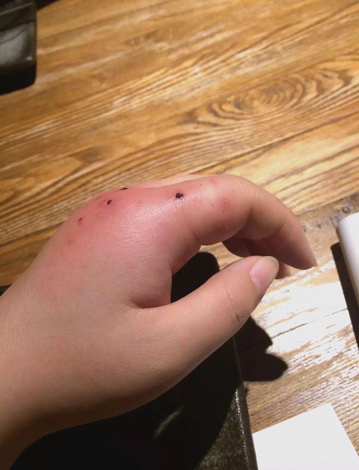 梦见猫咬我的手是什么预兆