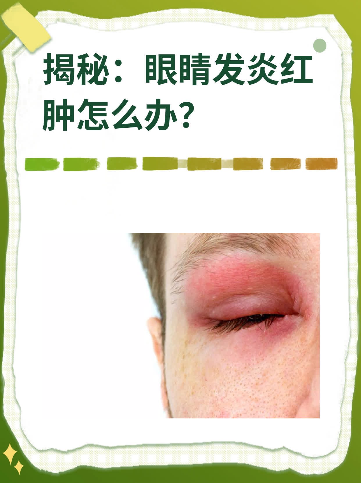眼睛里红痒是什么原因