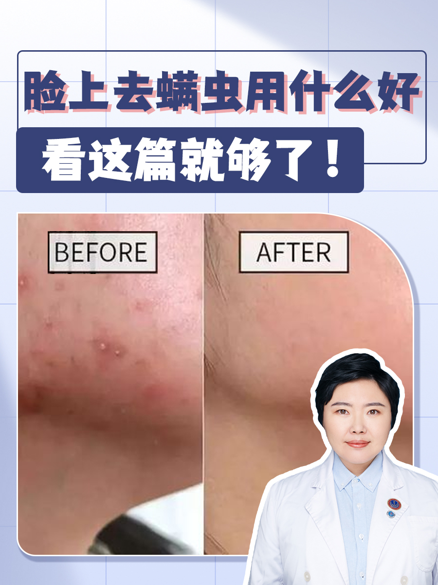脸上有螨虫怎么去除简单方法图片