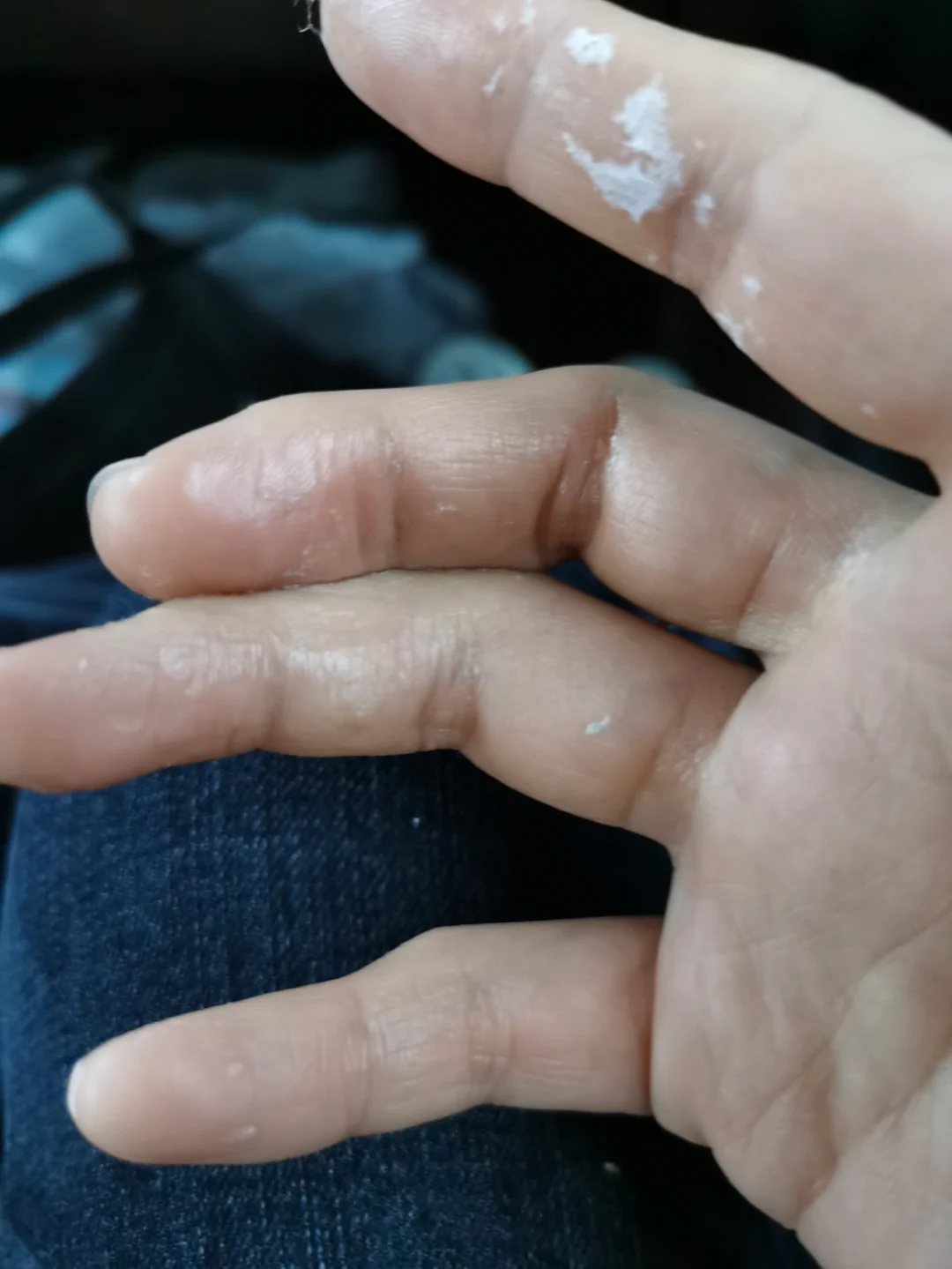 风油精能化解502胶水吗