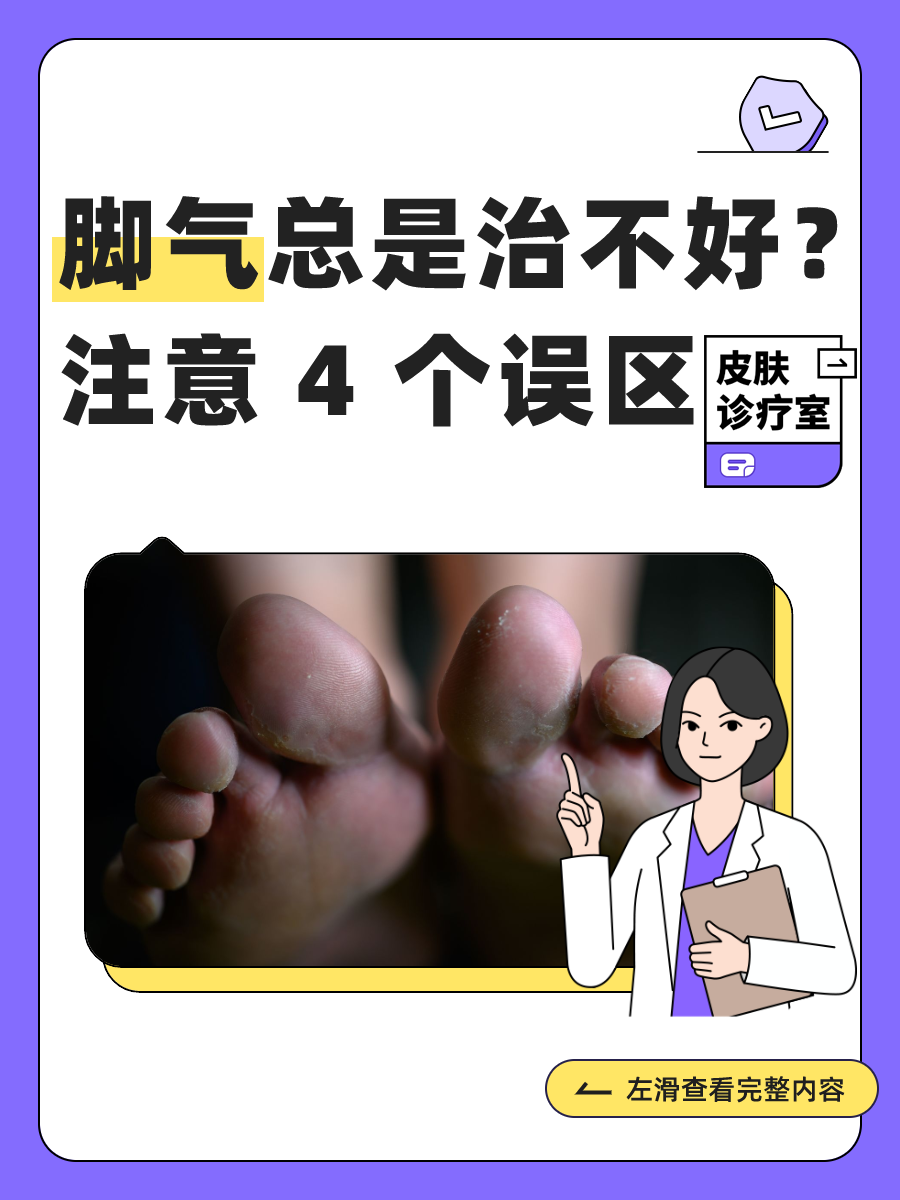 如何治脚气有效的方法