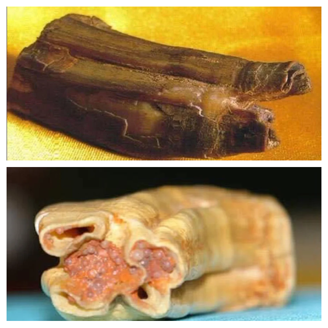 舍利子是怎么形成的,有什么作用?