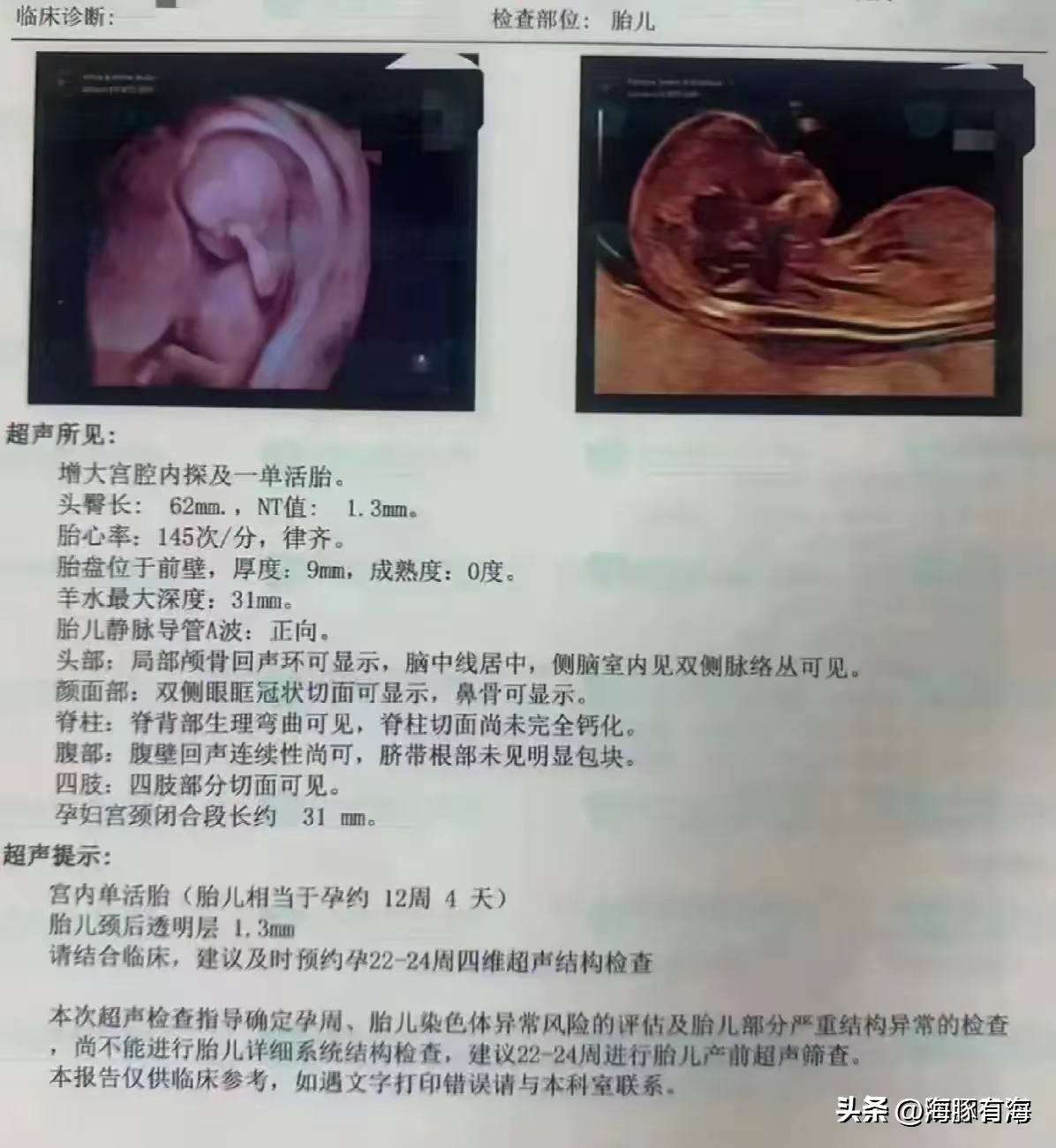 母胎solo什么意思网络语言