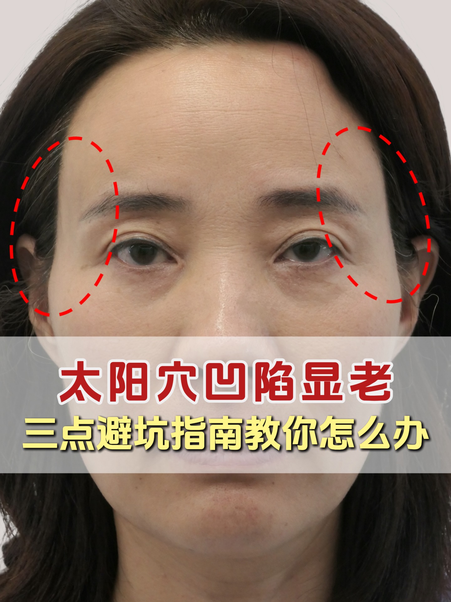 太阳凹陷怎样变饱满的妙招 按摩手法 视频