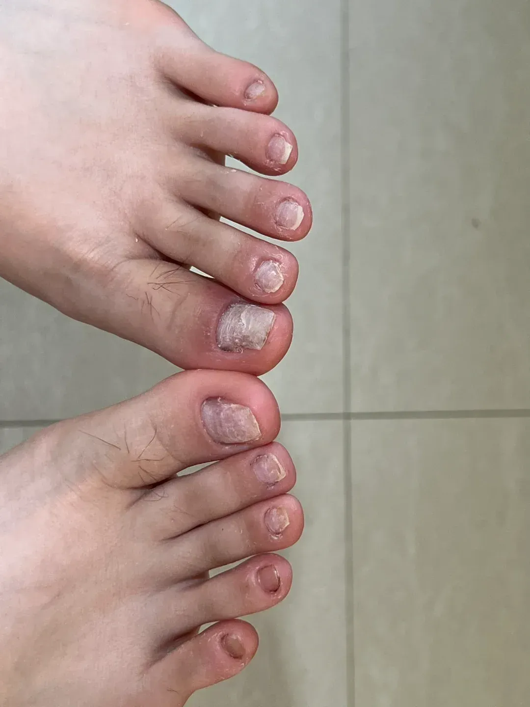 人的指甲怎么形成的