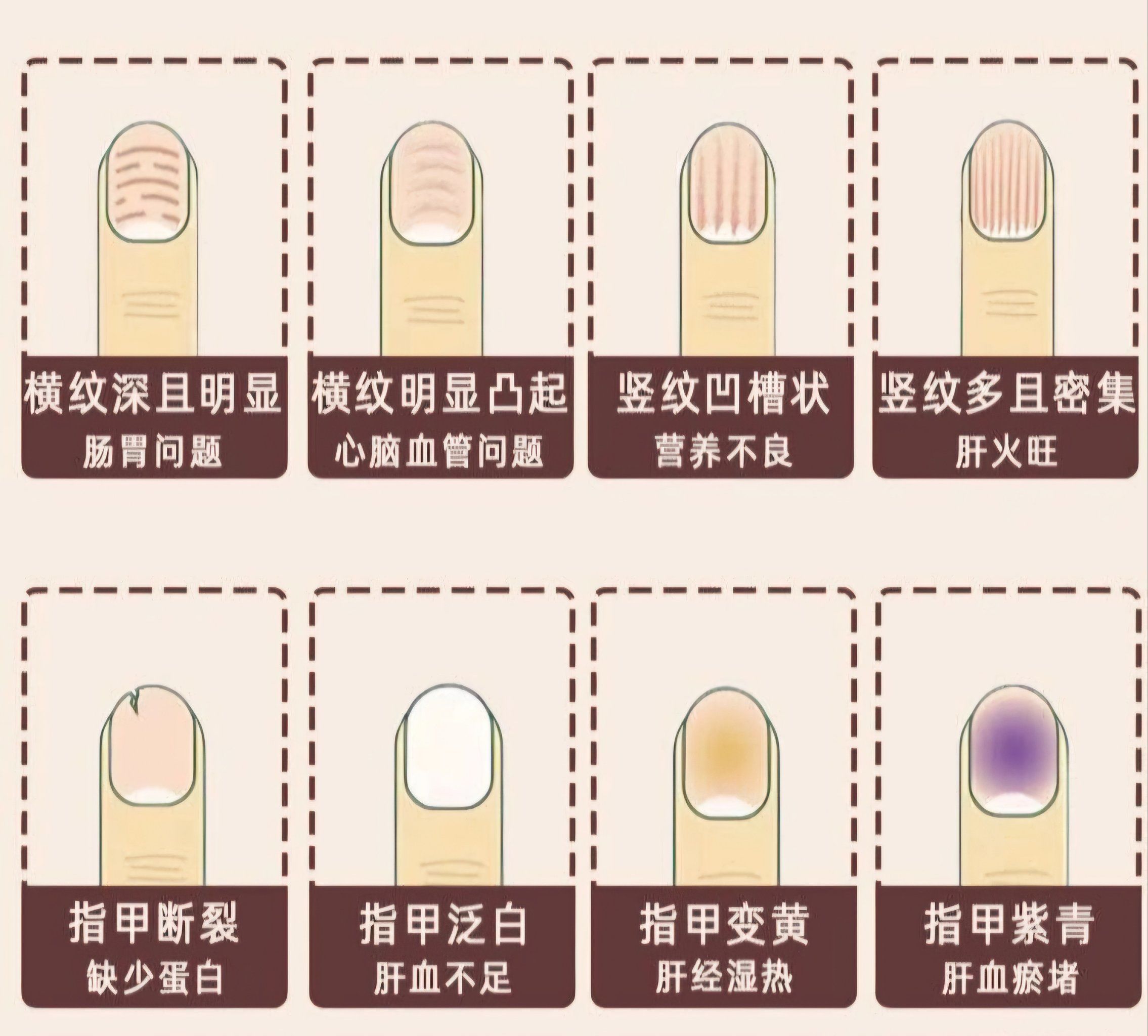 人的指甲怎么形成的