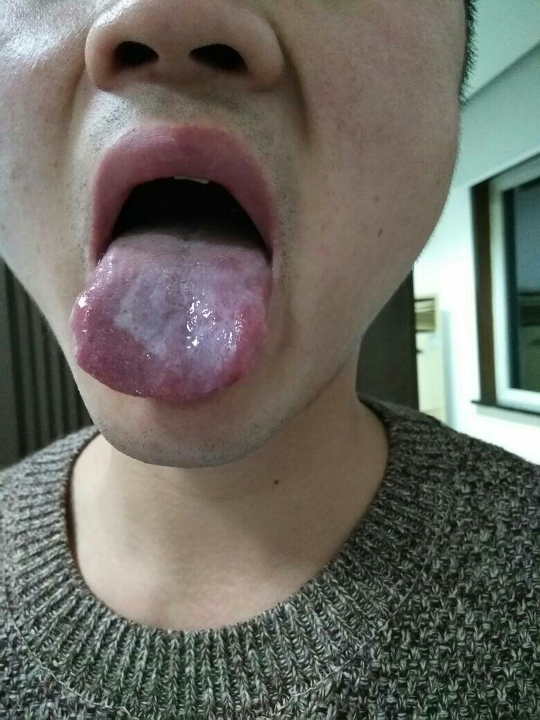 舌头没有了猜一个姓