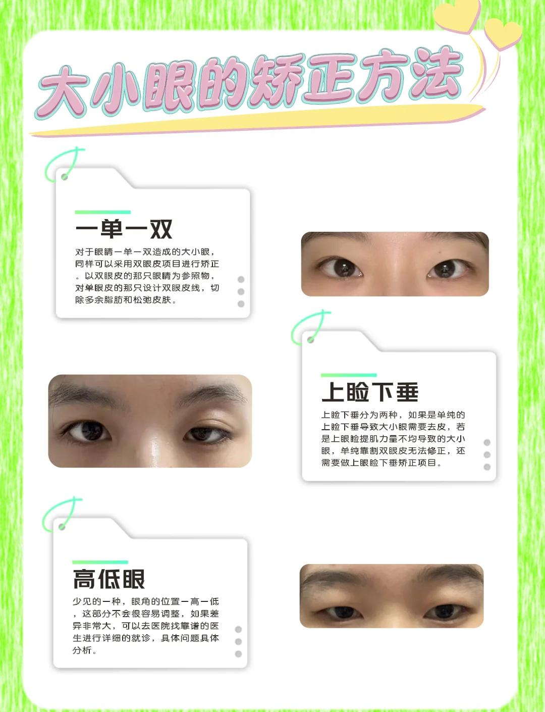 让眼睛变大变亮的方法