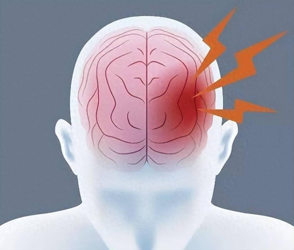 卒中的读音,为什么