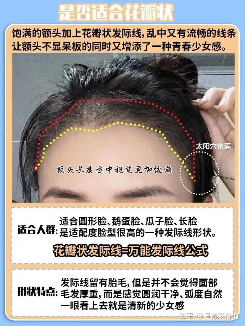 怎么调整发际线