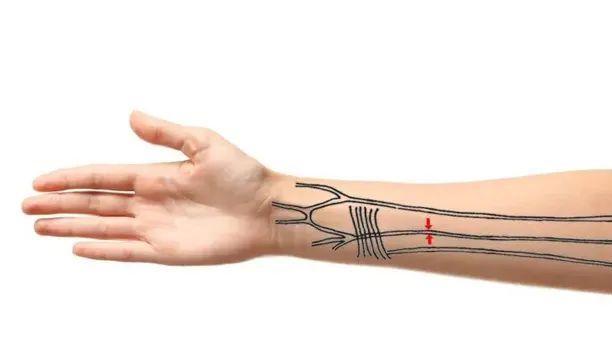 胳膊上的动脉图